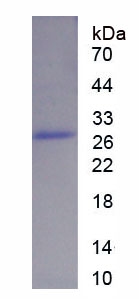 Recombinant Protein Kinase C Zeta (PKCz)