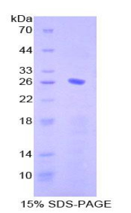 Recombinant Cluster of Differentiation 79B (CD79B)