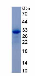 Recombinant Activating Transcription Factor 4 (ATF4)