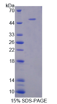 Recombinant B-Lymphocyte Activation Antigen B7-1 (LAB7-1)