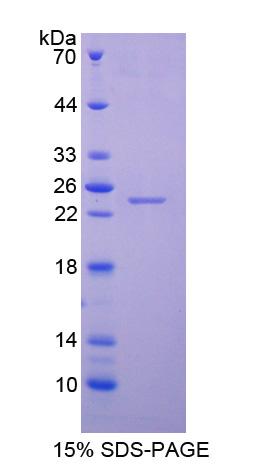 Recombinant Neutrophil gelatinase-associated lipocalin (NGAL)