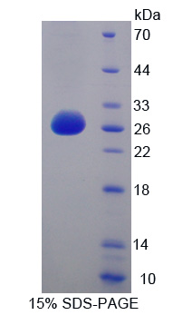 Recombinant Activating Transcription Factor 7 (ATF7)
