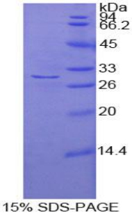 Recombinant Adenylate Cyclase 2, Brain (ADCY2)