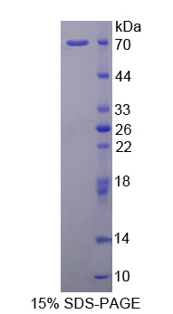 Recombinant Complement Component 1, Q Receptor (C1qR1)