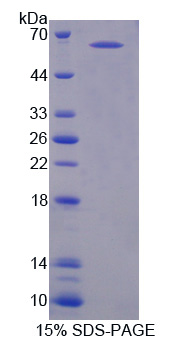 Recombinant Complement Component 1, Q Receptor (C1qR1)