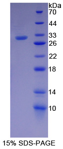 Recombinant Lipopolysaccharide Binding Protein (LBP)