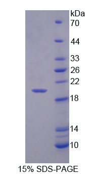 Recombinant Cluster Of Differentiation 99 (CD99)