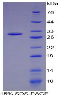 Recombinant Dopamine Beta Hydroxylase (DbH)