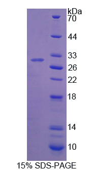 Recombinant Tyrosine Hydroxylase (TH)