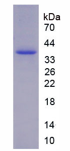 Recombinant Tyrosine Hydroxylase (TH)