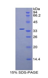 Recombinant Integrin Beta 4 (ITGb4)