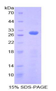 Recombinant Ribonuclease Inhibitor (RI)