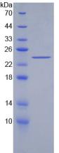 Recombinant Acetylcholinesterase (ACHE)