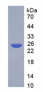 Recombinant Acetylcholinesterase (ACHE)