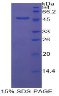 Recombinant Enolase 1 (ENO1)