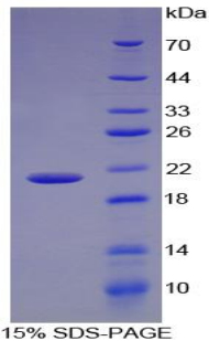 Recombinant Enolase 1 (ENO1)