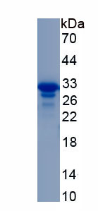 Recombinant Amylase, Alpha 2A (AMY2A)