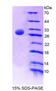 Recombinant Amylase, Alpha 2A (AMY2A)