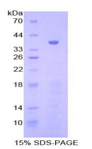 Recombinant Gamma-Lipotropic Hormone (gLPH)