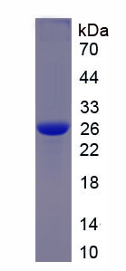 Recombinant Chitinase-3-like Protein 1 (CHI3L1)