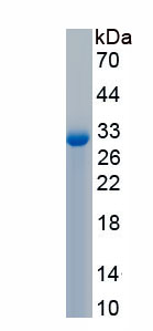 Recombinant Pitrilysin Metalloproteinase 1 (MP1)