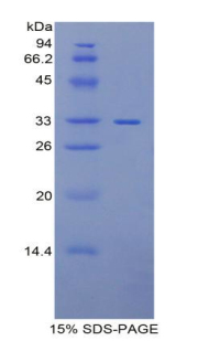 Recombinant Pitrilysin Metalloproteinase 1 (MP1)