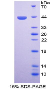 Recombinant Matrix Gla Protein (MGP)