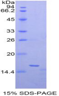 Recombinant Matrix Gla Protein (MGP)