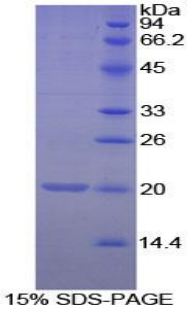 Recombinant Matrix Gla Protein (MGP)