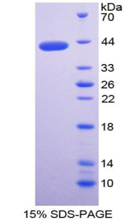 Recombinant Matrix Gla Protein (MGP)