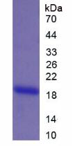 Recombinant Matrix Gla Protein (MGP)