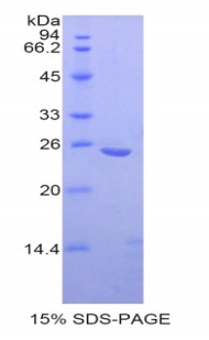 RPB478Hu01.jpg