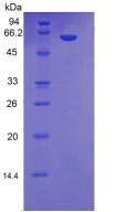 Recombinant Mannose Binding Lectin (MBL)