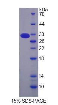 Recombinant Mannose Binding Lectin (MBL)