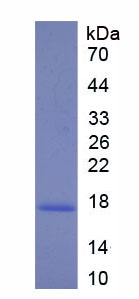 Recombinant Calreticulin (CALR)