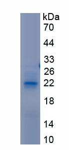 Recombinant Calreticulin (CALR)