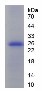 Recombinant Ornithine Transcarbamylase (OTC)