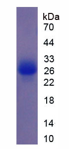 Recombinant Ornithine Transcarbamylase (OTC)