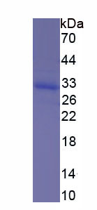 Recombinant Ornithine Transcarbamylase (OTC)