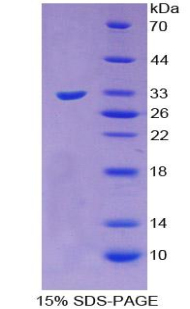 Recombinant Sorbitol Dehydrogenase (SDH)