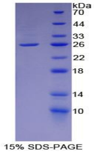 Recombinant Lumican (LUM)