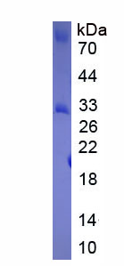 Recombinant Protein Disulfide Isomerase (PDI)