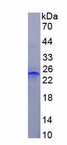 Recombinant Tumor Necrosis Factor Receptor 1 (TNFR1)