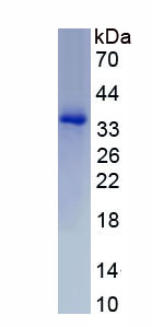 Recombinant Collectin Liver 1 (CLL1)