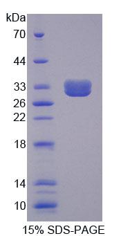 Recombinant Tumor Necrosis Factor Receptor Superfamily, Member 1B (TNFRSF1B)