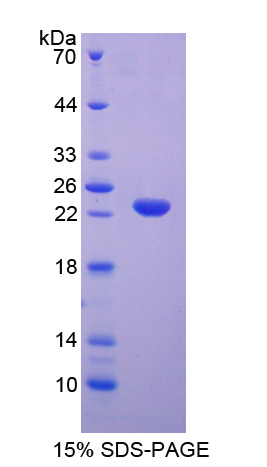 Recombinant Interleukin 5 Receptor Alpha (IL5Ra)