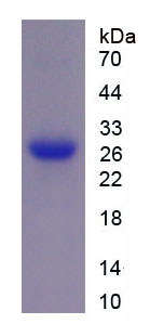 Recombinant Interleukin 2 Receptor Gamma (IL2Rg)