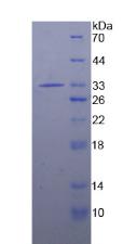 Recombinant Interleukin 1 Receptor Associated Kinase 2 (IRAK2)