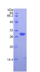 Recombinant Interleukin 1 Receptor Associated Kinase 2 (IRAK2)