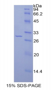 Recombinant Interleukin 1 Receptor Associated Kinase 2 (IRAK2)